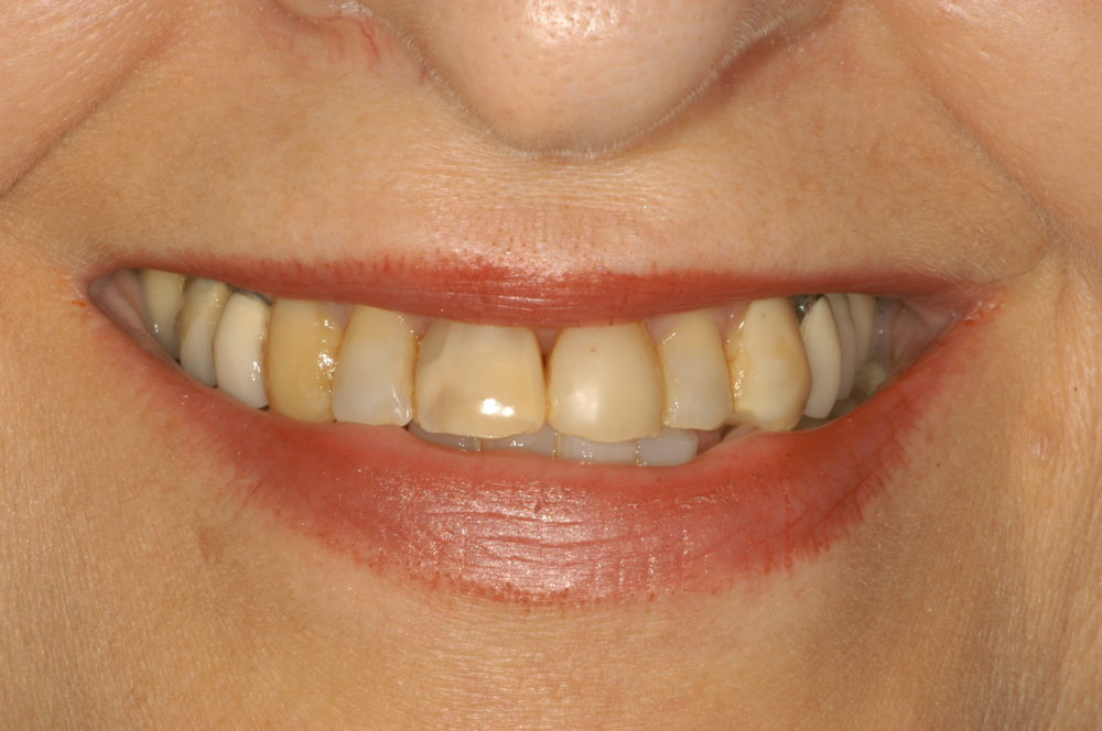 Magnolia Dental | Dentist in Louisville KY -