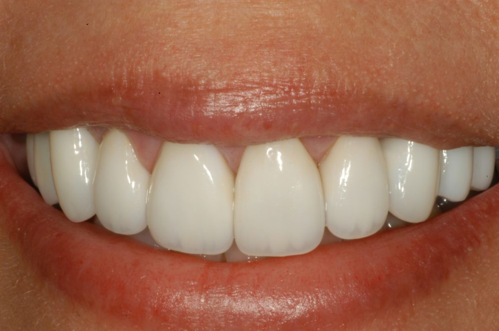Magnolia Dental | Dentist in Louisville KY -