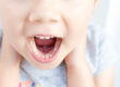Orthodontic Treatment in Louisville crooked teeth